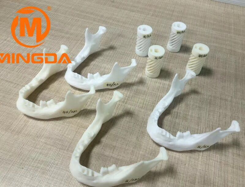 工業(yè)級(jí)3D打印機(jī)在牙科行業(yè)的應(yīng)用(圖1)