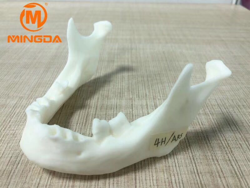 工業(yè)級(jí)3D打印機(jī)在牙科行業(yè)的應(yīng)用(圖1)